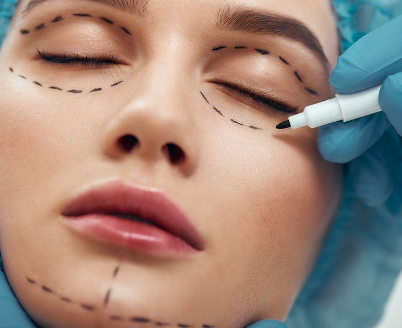 Tratamiento de Cirugía estética facial